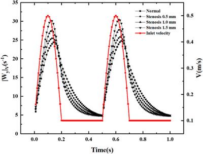 Numerical investigation of the effect of carotid bifurcation stenosis degree on pulsatility characteristics